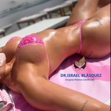 Slider image (6) Dr. Israel Villalobos - Plastic Surgery in Tijuana Mexico